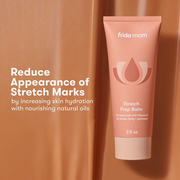 Frida Mom Stretch Mark Cream, Moisturizing Lotion for Stretch Marks and Perineal, 2.5oz
