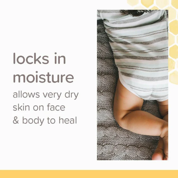 Burt's Bees Baby Multipurpose Healing Ointment - 212g - Dezine Kids